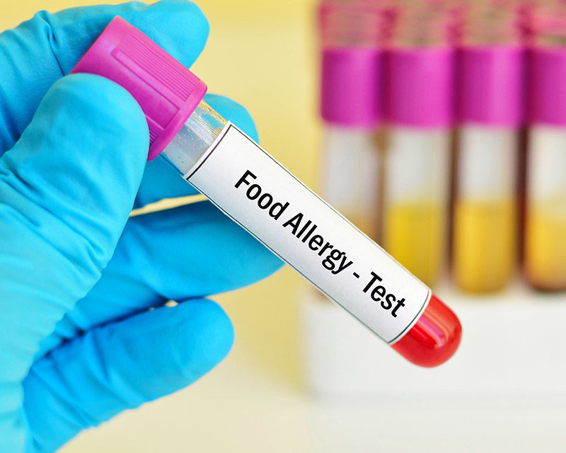 igg food allergy